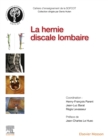 La hernie discale lombaire - eBook