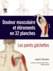 Douleur musculaire et etirements en 32 planches : Les points gachettes - eBook