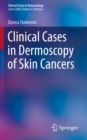 Clinical Cases in Dermoscopy of Skin Cancers - eBook