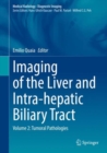 Imaging of the Liver and Intra-hepatic Biliary Tract : Volume 2: Tumoral Pathologies - eBook