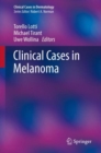 Clinical Cases in Melanoma - eBook