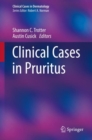 Clinical Cases in Pruritus - eBook