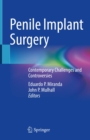 Penile Implant Surgery : Contemporary Challenges and Controversies - eBook