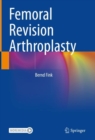 Femoral Revision Arthroplasty - eBook