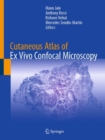 Cutaneous Atlas of Ex Vivo Confocal Microscopy - eBook