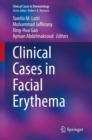 Clinical Cases in Facial Erythema - eBook