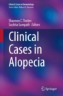 Clinical Cases in Alopecia - eBook