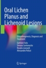 Oral Lichen Planus and Lichenoid Lesions : Etiopathogenesis, Diagnosis and Treatment - eBook