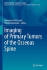 Imaging of Primary Tumors of the Osseous Spine - eBook