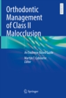 Orthodontic Management of Class II Malocclusion : An Evidence-Based Guide - eBook