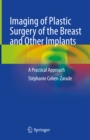 Imaging of Plastic Surgery of the Breast and Other Implants : A Practical Approach - eBook