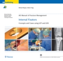AO Manual of Fracture Management: Internal Fixators : Concepts and Cases using LCP/LISS - eBook