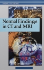 Normal Findings in CT and MRI - eBook