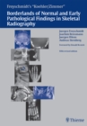 Freyschmidt's "Koehler/Zimmer" Borderlands of Normal and Early Pathological Findings in Skeletal Radiography - eBook