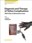 Diagnosis and Therapy of Tattoo Complications : With Atlas of Illustrative Cases. - eBook