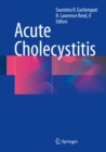 Acute Cholecystitis - eBook