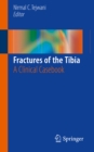 Fractures of the Tibia : A Clinical Casebook - eBook