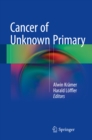 Cancer of Unknown Primary - eBook