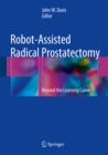 Robot-Assisted Radical Prostatectomy : Beyond the Learning Curve - eBook
