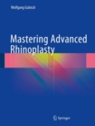 Mastering Advanced Rhinoplasty - eBook