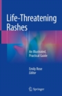 Life-Threatening Rashes : An Illustrated, Practical Guide - eBook