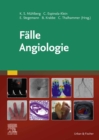 Falle Angiologie - eBook