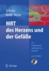 MRT des Herzens und der Gefae : Indikationen - Strategien - Ablaufe - Ergebnisse - eBook