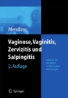 Vaginose, Vaginitis, Zervizitis und Salpingitis - eBook