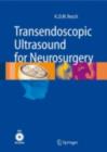 Transendoscopic Ultrasound for Neurosurgery - eBook