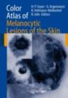 Color Atlas of Melanocytic Lesions of the Skin - eBook