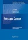 Prostate Cancer - eBook