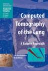 Computed Tomography of the Lung : A Pattern Approach - eBook