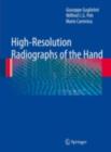 High-Resolution Radiographs of the Hand - eBook