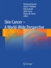 Skin Cancer - A World-Wide Perspective - eBook