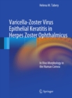 Varicella-Zoster Virus Epithelial Keratitis in Herpes Zoster Ophthalmicus : In Vivo Morphology in the Human Cornea - eBook