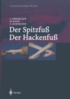 Fussdeformitaten : Der Spitzfuss/Der Hackenfuss - eBook