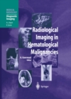 Radiological Imaging in Hematological Malignancies - eBook