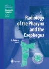 Radiology of the Pharynx and the Esophagus - eBook