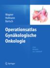 Operationsatlas Gynakologische Onkologie - eBook