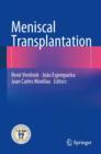 Meniscal Transplantation - eBook