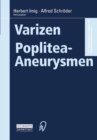 Varizen * Poplitea-Aneurysmen - eBook