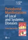 Periodontal Manifestations of Local and Systemic Diseases : Colour Atlas and Text - eBook