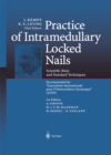 Practice of Intramedullary Locked Nails : Scientific Basis and Standard Techniques Recommended "Association Internationale pour I'Osteosynthese Dynamique" (AIOD) - eBook