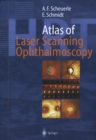 Atlas of Laser Scanning Ophthalmoscopy - eBook