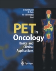 PET in Oncology : Basics and Clinical Application - eBook