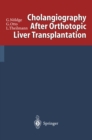 Cholangiography After Orthotopic Liver Transplantation - eBook