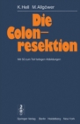 Die Colonresektion - eBook
