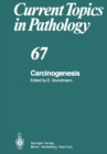 Carcinogenesis - eBook