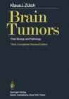 Brain Tumors : Their Biology and Pathology - eBook