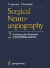 Surgical Neuroangiography : 2 Endovascular Treatment of Craniofacial Lesions - eBook